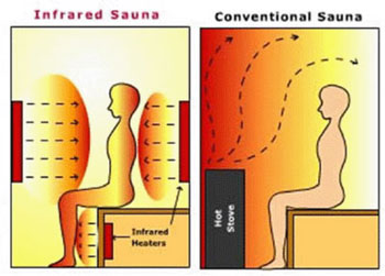 Infracrvene saune